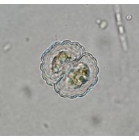 Cosmarium subprotumidum
