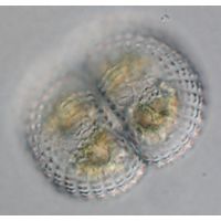Cosmarium subspeciosum