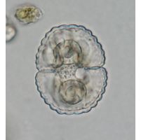 Cosmarium subspeciosum