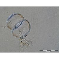 Cosmarium subtumidum
