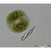 Cosmarium taxichondriforme