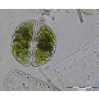Cosmarium taxichondriforme