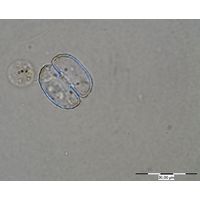 Cosmarium tetrachondrum