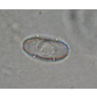 Cosmarium tetrachondrum