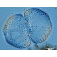 Cosmarium tetraophtalmum