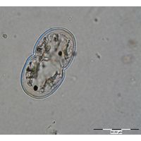 Cosmarium thwaitesii
