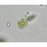 Cosmarium tinctum
