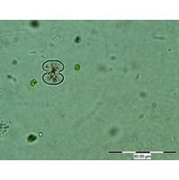 Cosmarium tinctum
