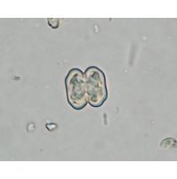 Cosmarium tinctum