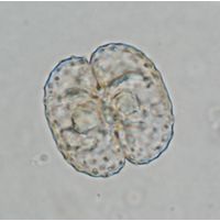 Cosmarium trachypleurum