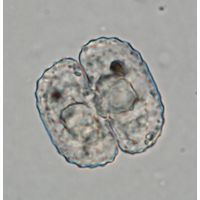 Cosmarium trachypleurum