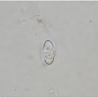Cosmarium
