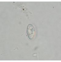 Cosmarium