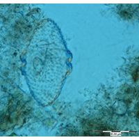 Cosmarium turpinii