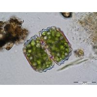 Cosmarium ungerianum