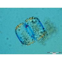 Cosmarium ungerianum