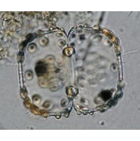 Cosmarium ungerianum
