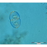 Cosmarium variolatum