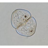 Cosmarium variolatum