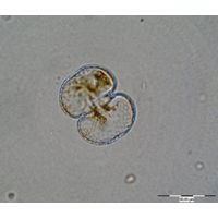 Cosmarium varsoviense