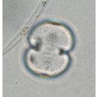 Cosmarium varsoviense