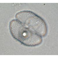 Cosmarium varsoviense