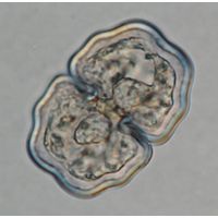 Cosmarium venustum
