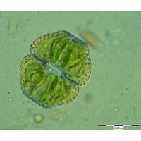 Cosmarium vexatum