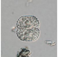 Cosmarium vogesiacum