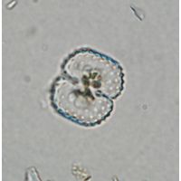 Cosmarium vogesiacum