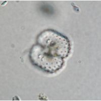 Cosmarium vogesiacum