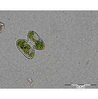 Cosmarium wittrockii