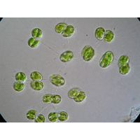 Cosmocladium saxonicum