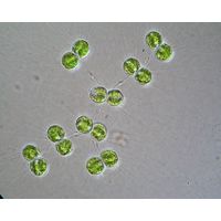 Cosmocladium saxonicum