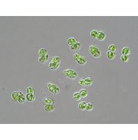 Cosmocladium saxonicum