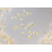 Cosmocladium saxonicum