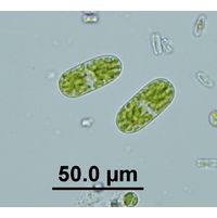 Cylindrocystis brebissonii