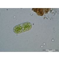Cylindrocystis brebissonii