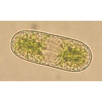 Cylindrocystis brebissonii