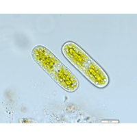 Cylindrocystis brebissonii