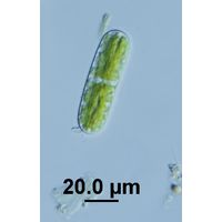 Cylindrocystis brebissoni