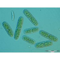 Cylindrocystis