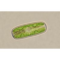 Cylindrocystis
