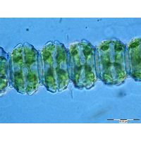 Desmidium cylindricum