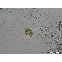 Euastrum binale