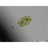 Euastrum pulchellum