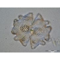 Euastrum verrucosum