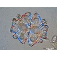 Euastrum verrucosum