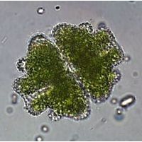Euastrum verrucosum