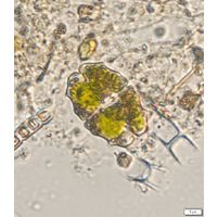 Euastrum elegans